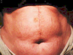 scar.jpg (14828 bytes)