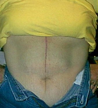 scar3mo.JPG (32838 bytes)